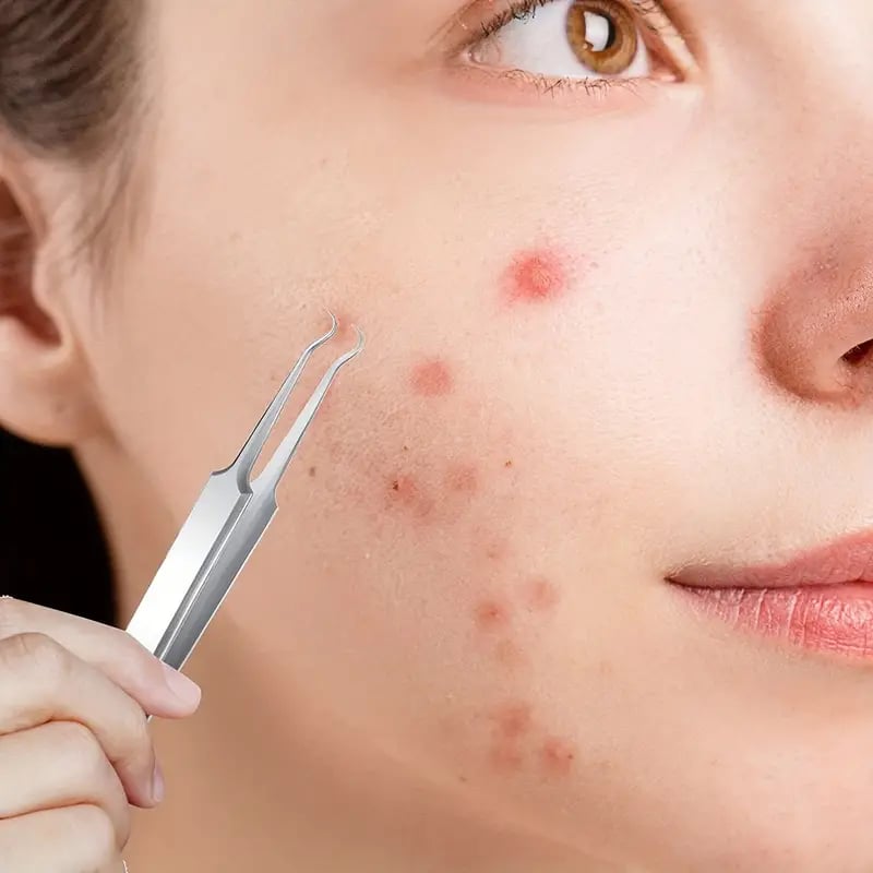SkinClear Precision Kit